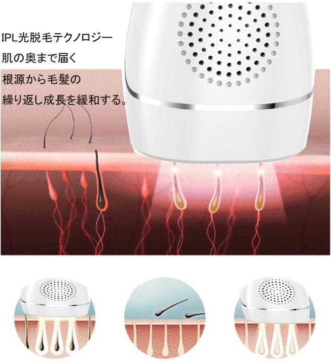脱毛器 レーザー 永久脱毛