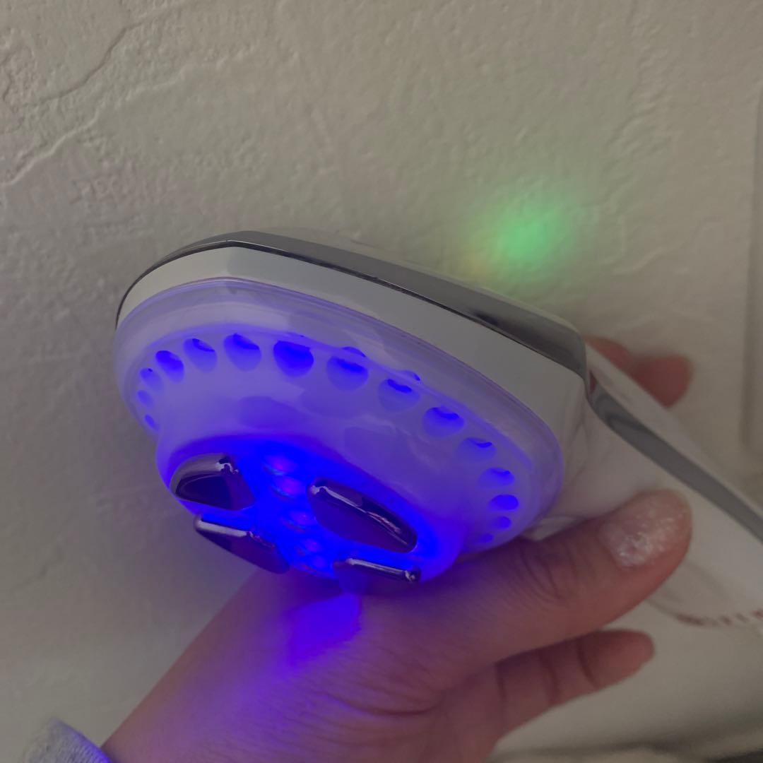 APPB アップビー