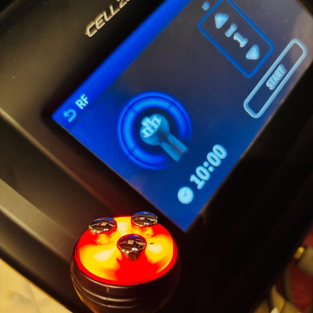 じぶんdeエステ　セルゼロファスト　吸引　RF