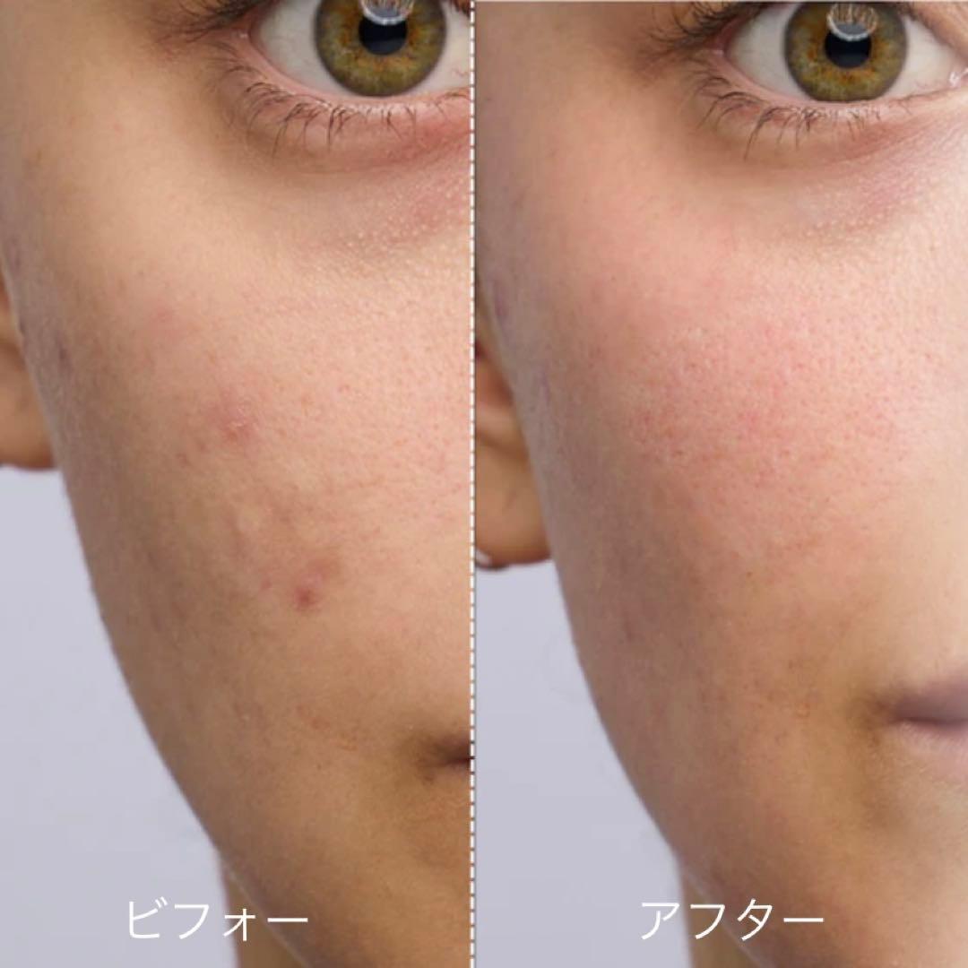 ZIIP DOT 美顔器 グレー