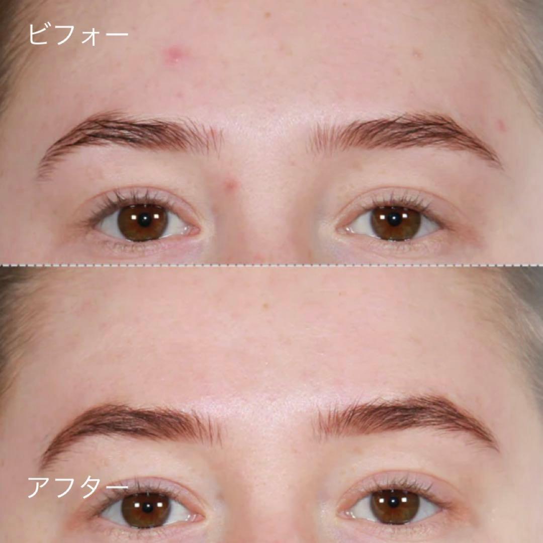 ZIIP DOT 美顔器 グレー