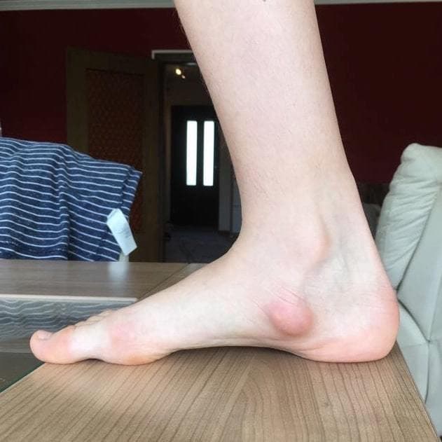 SK8INSOLL® DOUBLE AXEL カスタマイズインソール   XXS