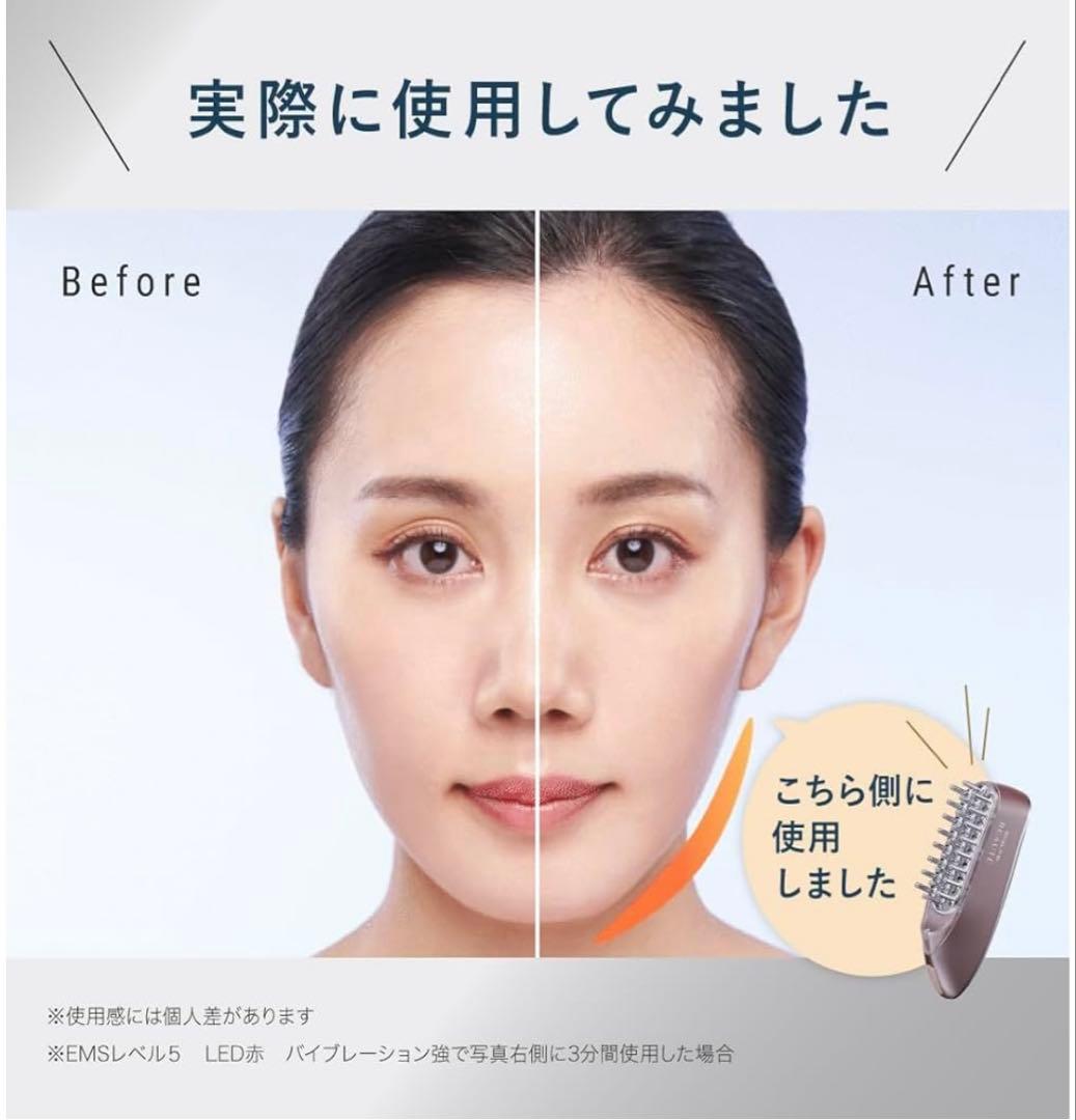 スカルプD ボーテ EMS美顔器