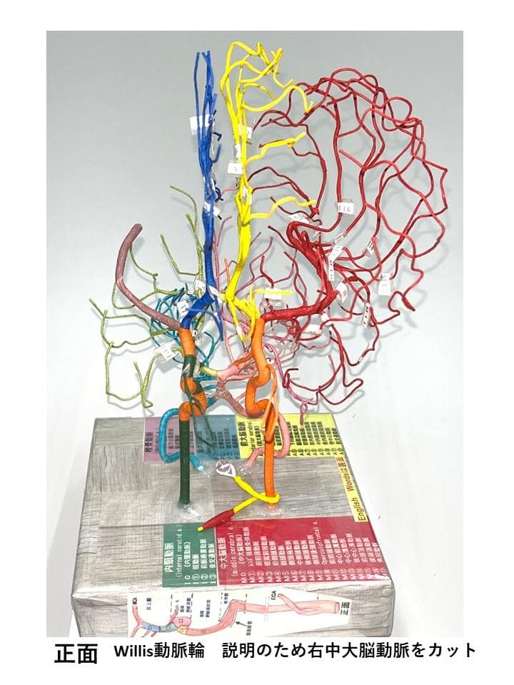 脳血管模型　教育説明用（脳血管模型が必要な人のために）