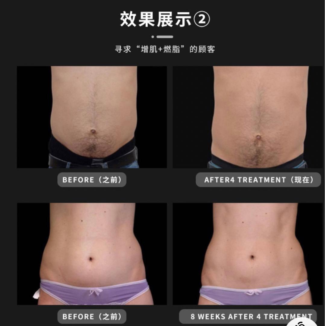 エムズ痩身機器HIMET  新品