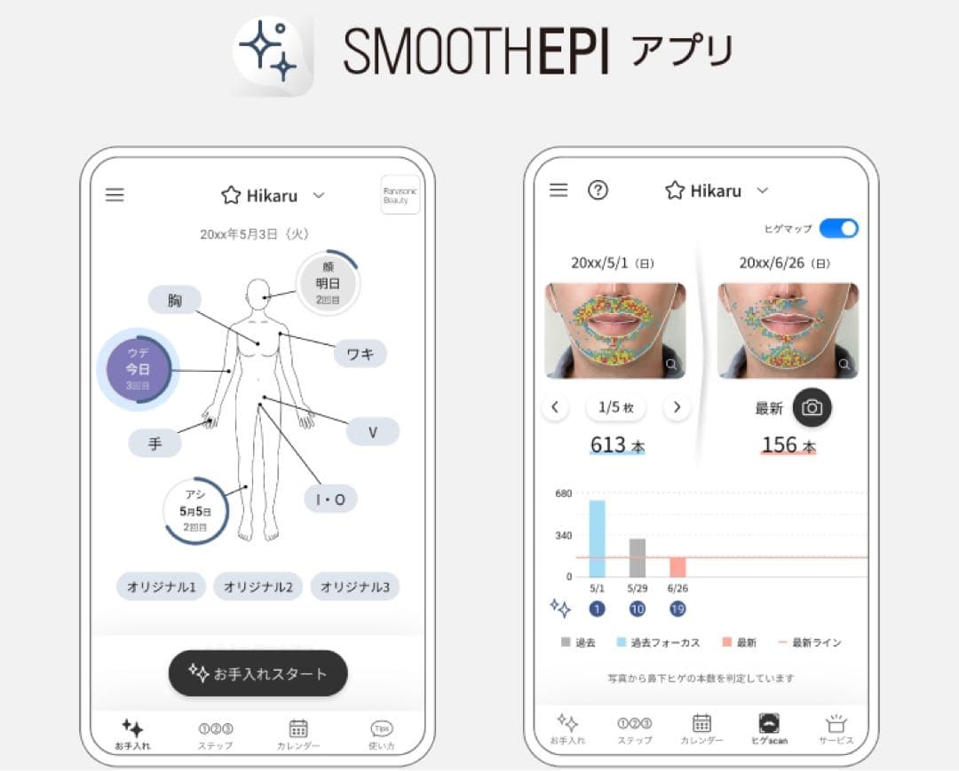 5年保証　SMOOTHEPI 美顔器 光エステ スムースエピ ES-WG0A