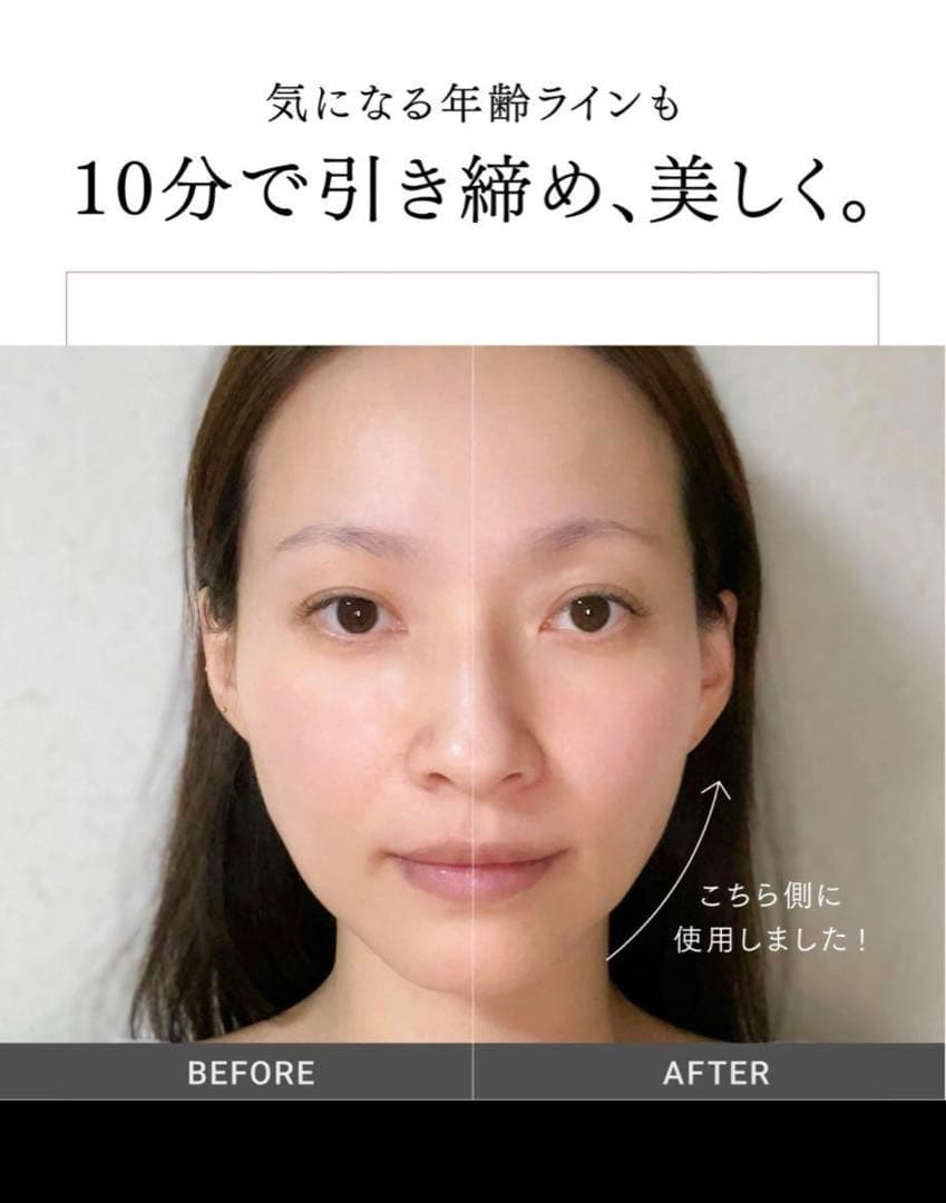 【新品同様】MYTREX PROVE美顔器