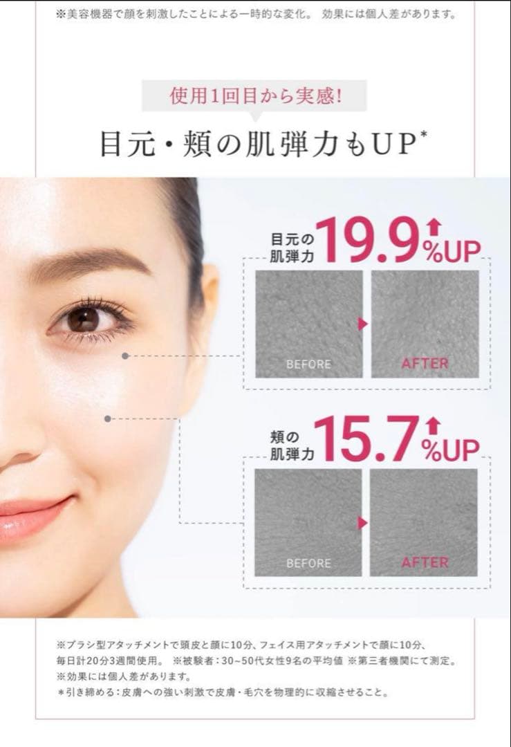 【新品同様】MYTREX PROVE美顔器