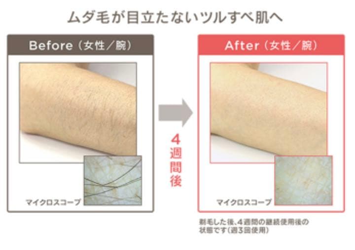 ★ムダ毛ケア フラッシュ式【MEスマートエピレーションプレミアム】光美容器未使用