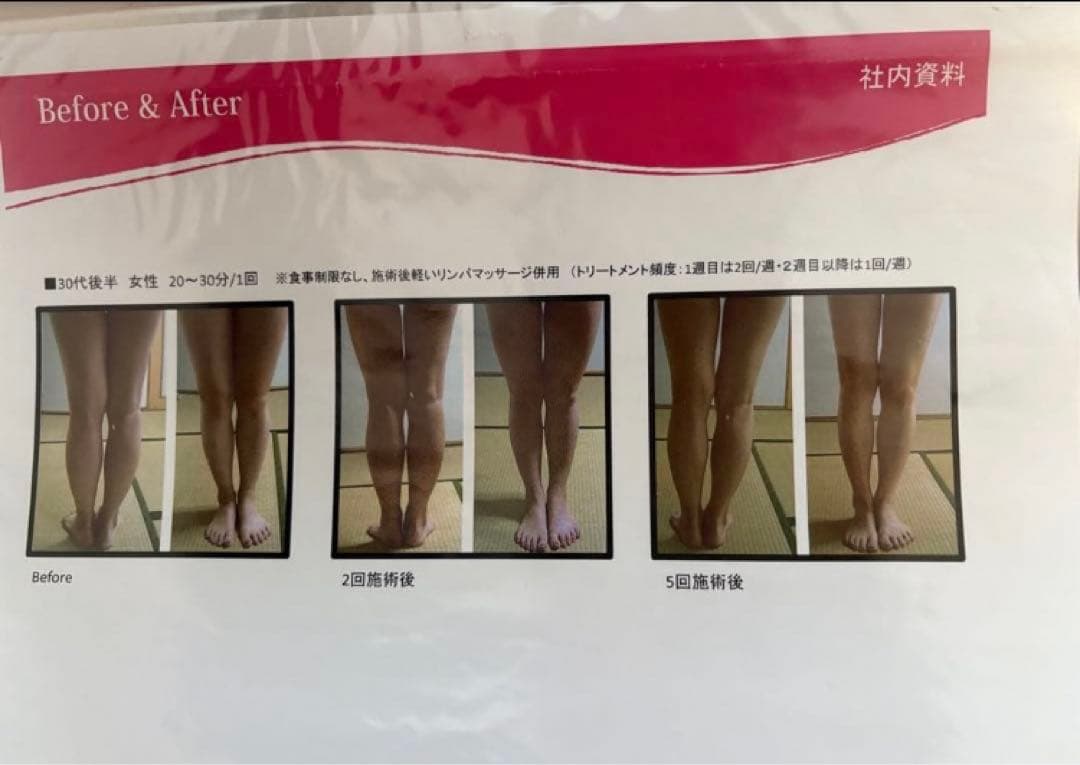 大手エステサロン導入品　業務用　キャビコンパクト