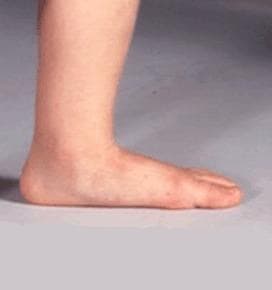 SK8INSOLL® DOUBLE AXEL カスタマイズインソール サイズ S