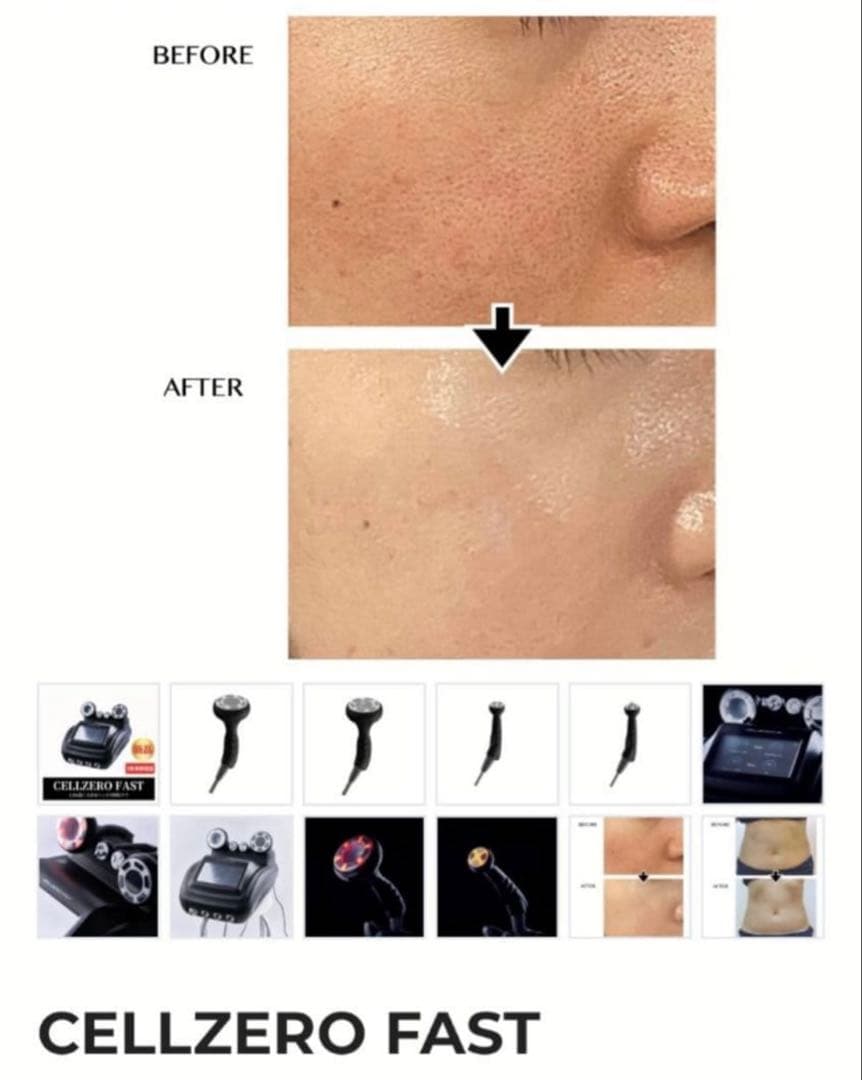 人気商品　CELLZERO FAST セルゼロファスト