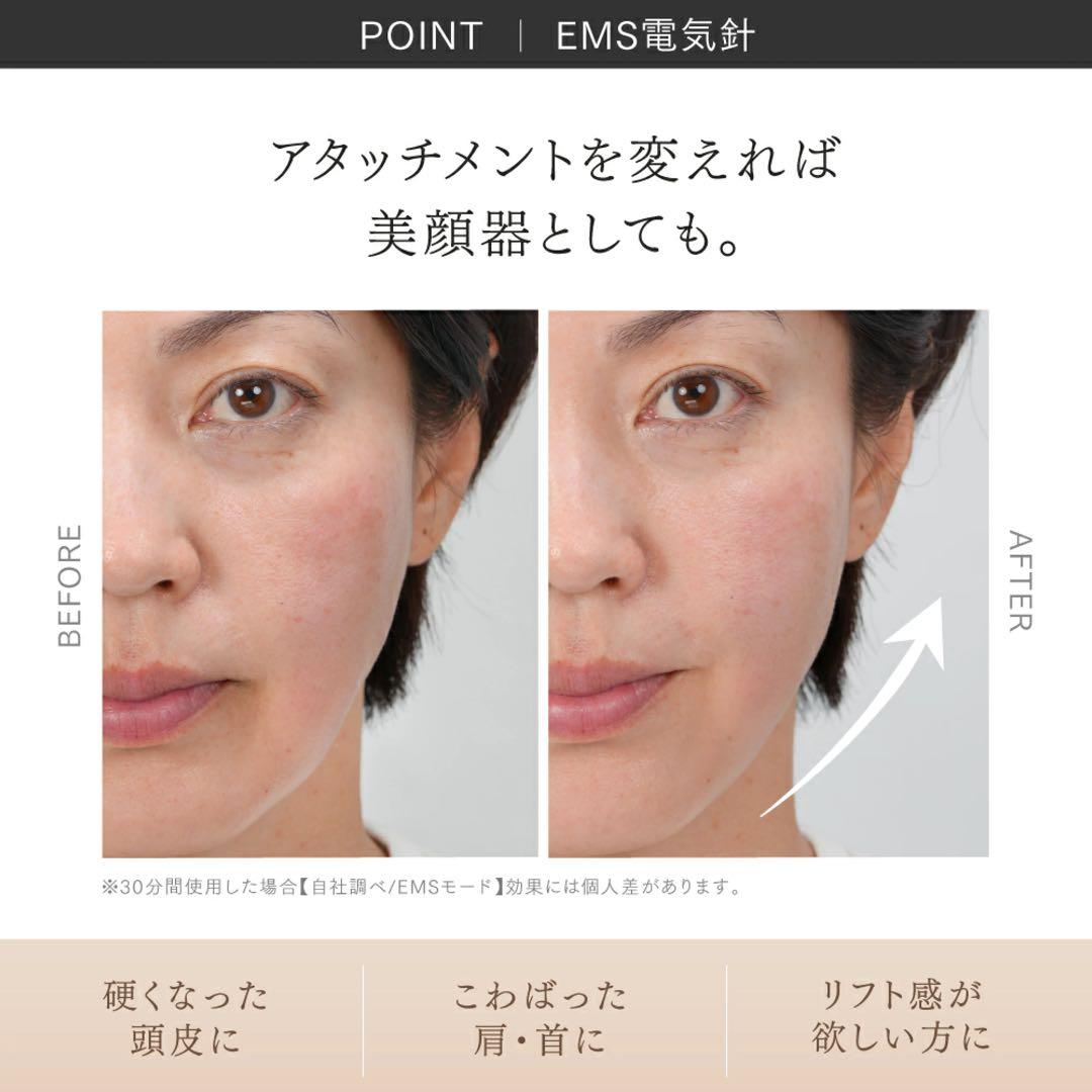 【美品】マイトレックスヘッドスパ　 MYTREX HEAD SPA DEEP X