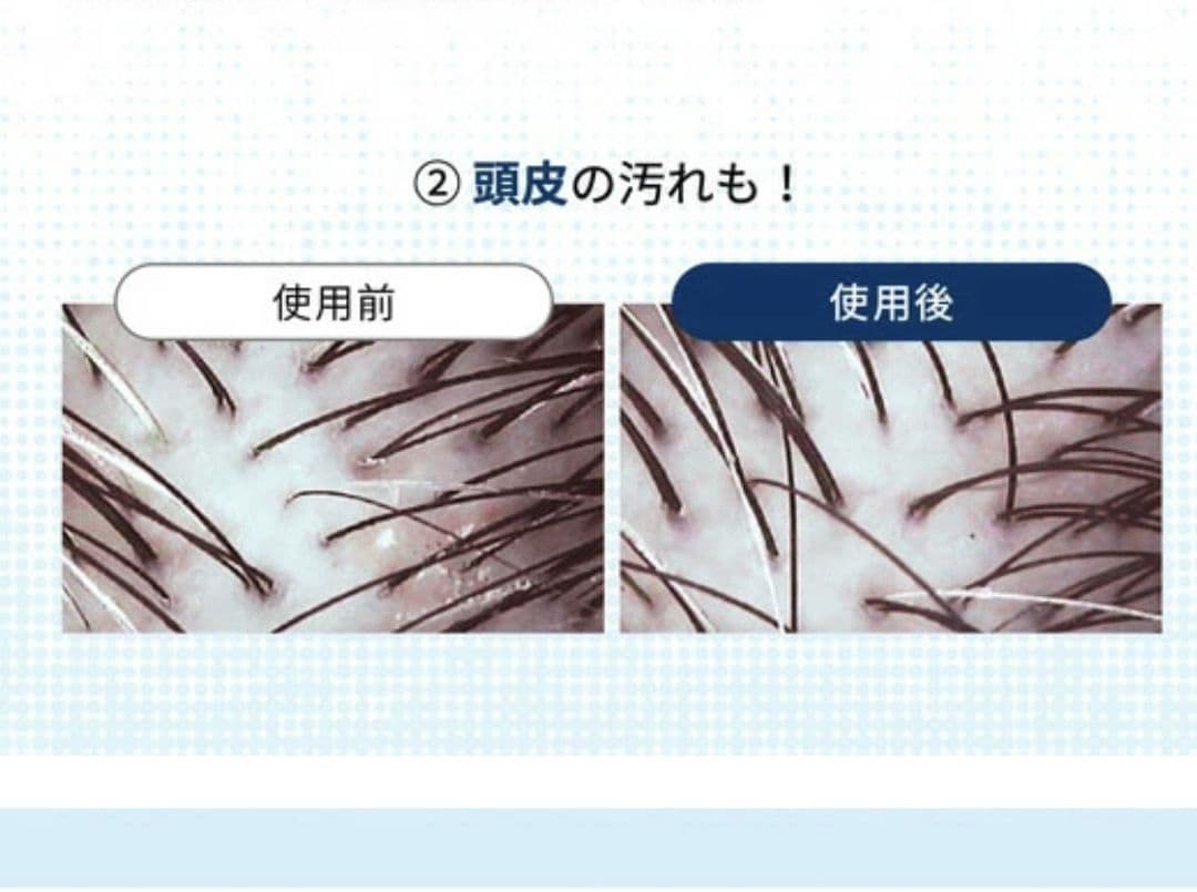 ReFa リファファインバブル RF-MB2307B MTG