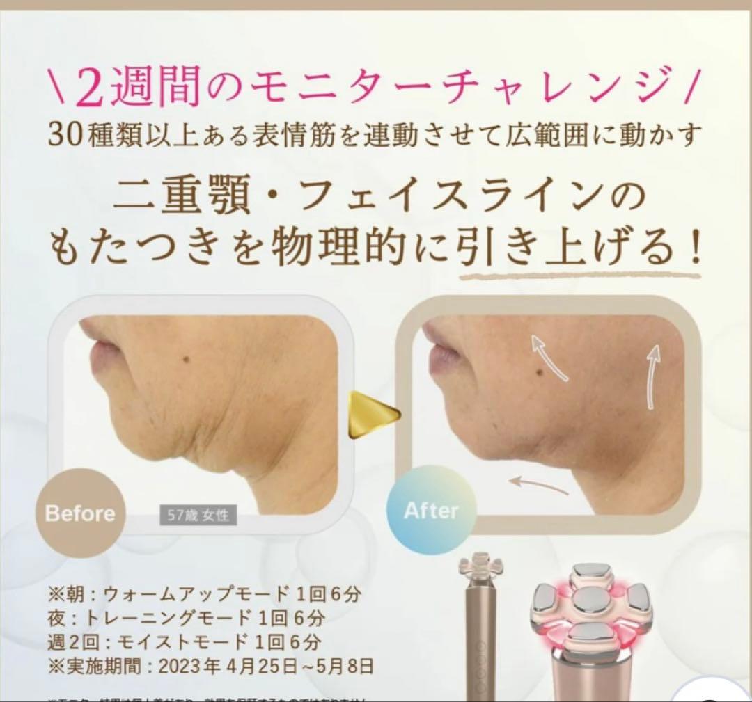 美顔器クリニック級幹細胞湘南美容外科全面監督医療レベル美顔器ベビースキン4回付得