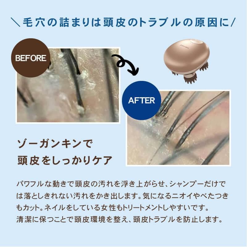 ゾーガンキンスカルプ EMS ヘッドスパ 180g スカルプブラシ 頭皮ブラシ